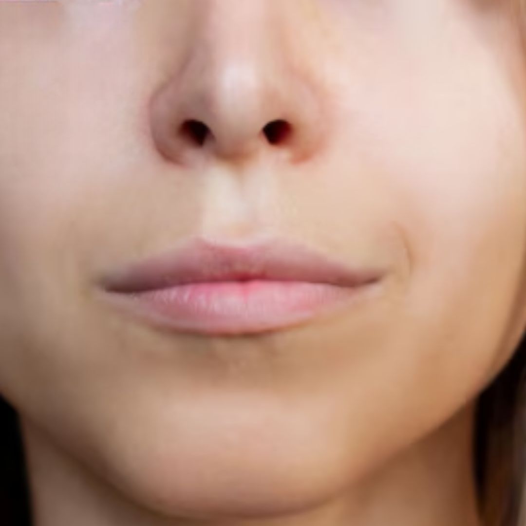 Close-up of lips before lipfiller