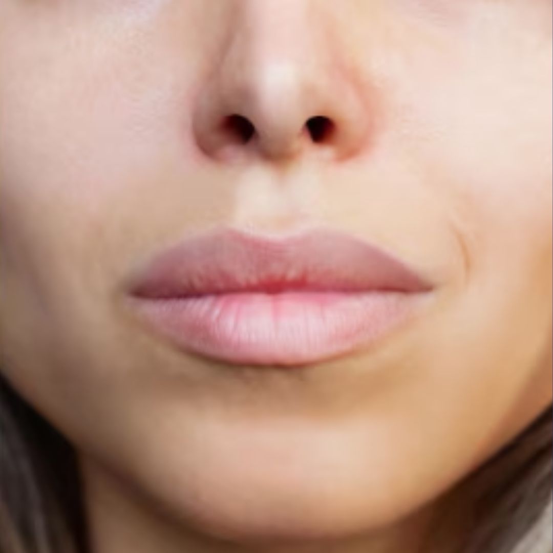 Close-up of lips post-lipfiller