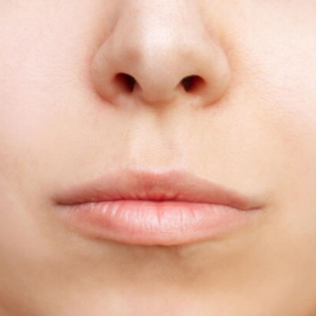 Frontal image of the face before lipfiller